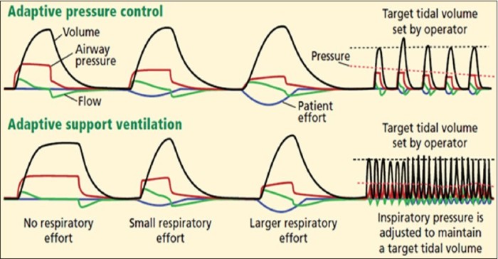 Updated Adaptive Servo-Ventilation Recommendations for the 2012 AASM