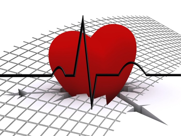CPAP and Cardiovascular Health - Thoracic and Sleep Group Queensland