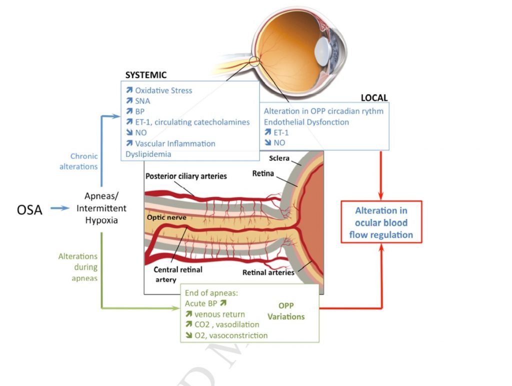 Sleep And Eye Disorders - Thoracic And Sleep Group Queensland