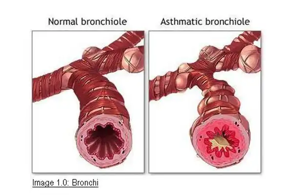 asthma-and-diving