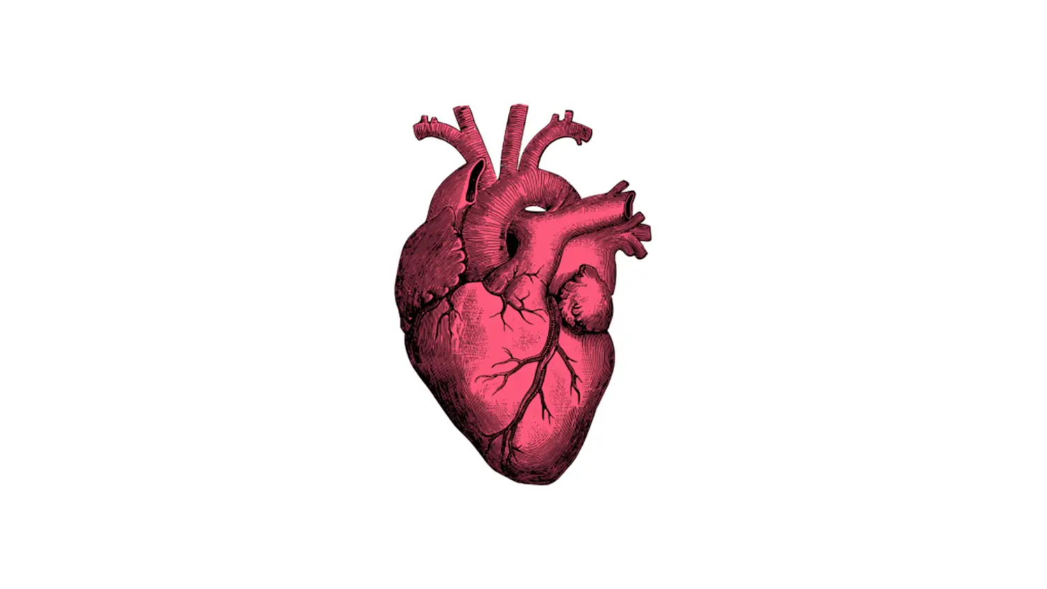 OSA and cardiovascular disease