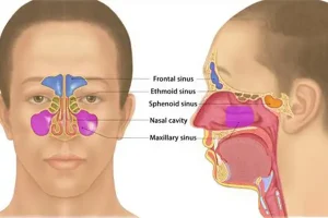 Sinuses-of-the-Face-