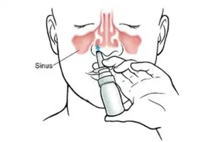 nasal-spray